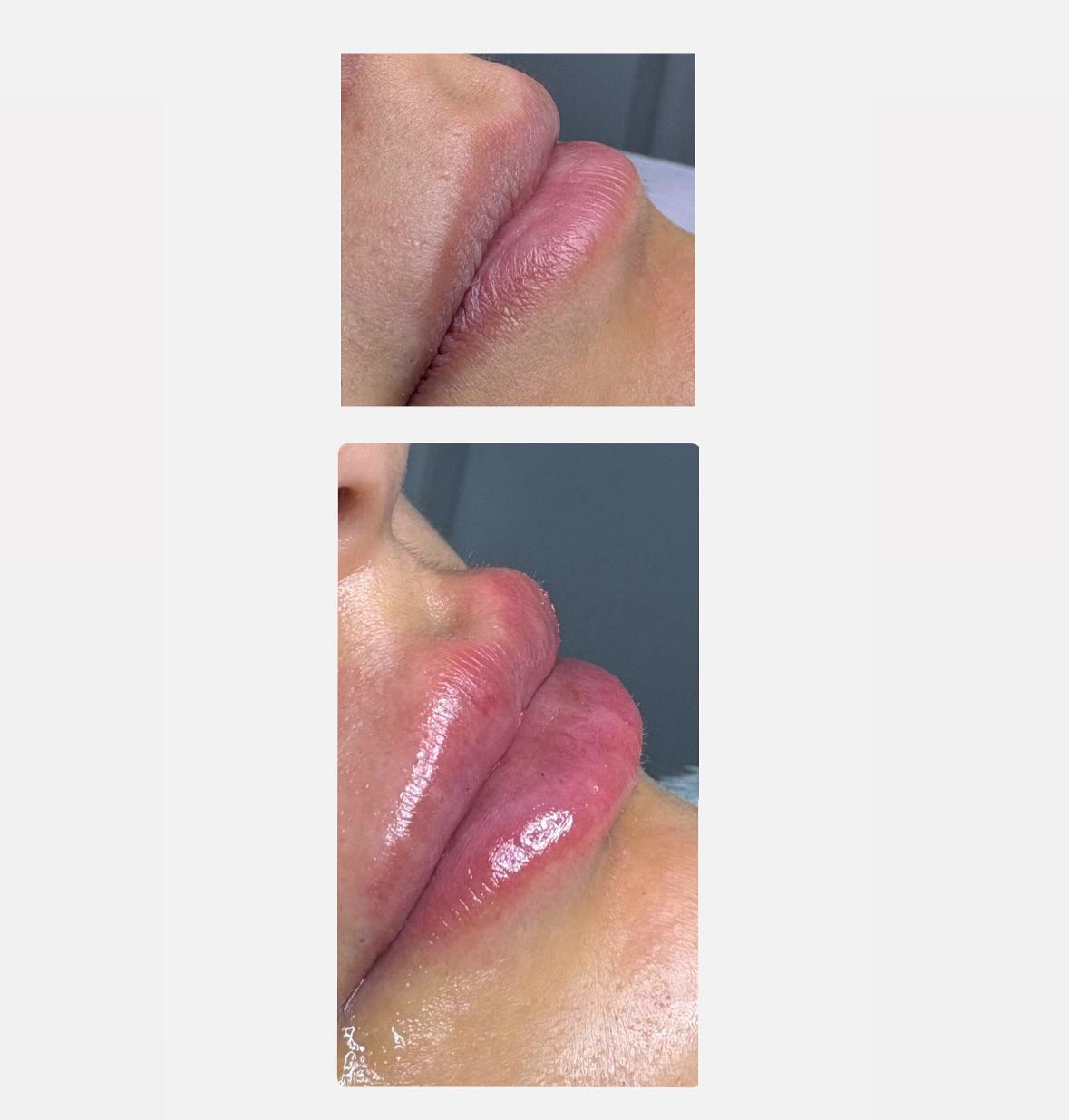 1ml